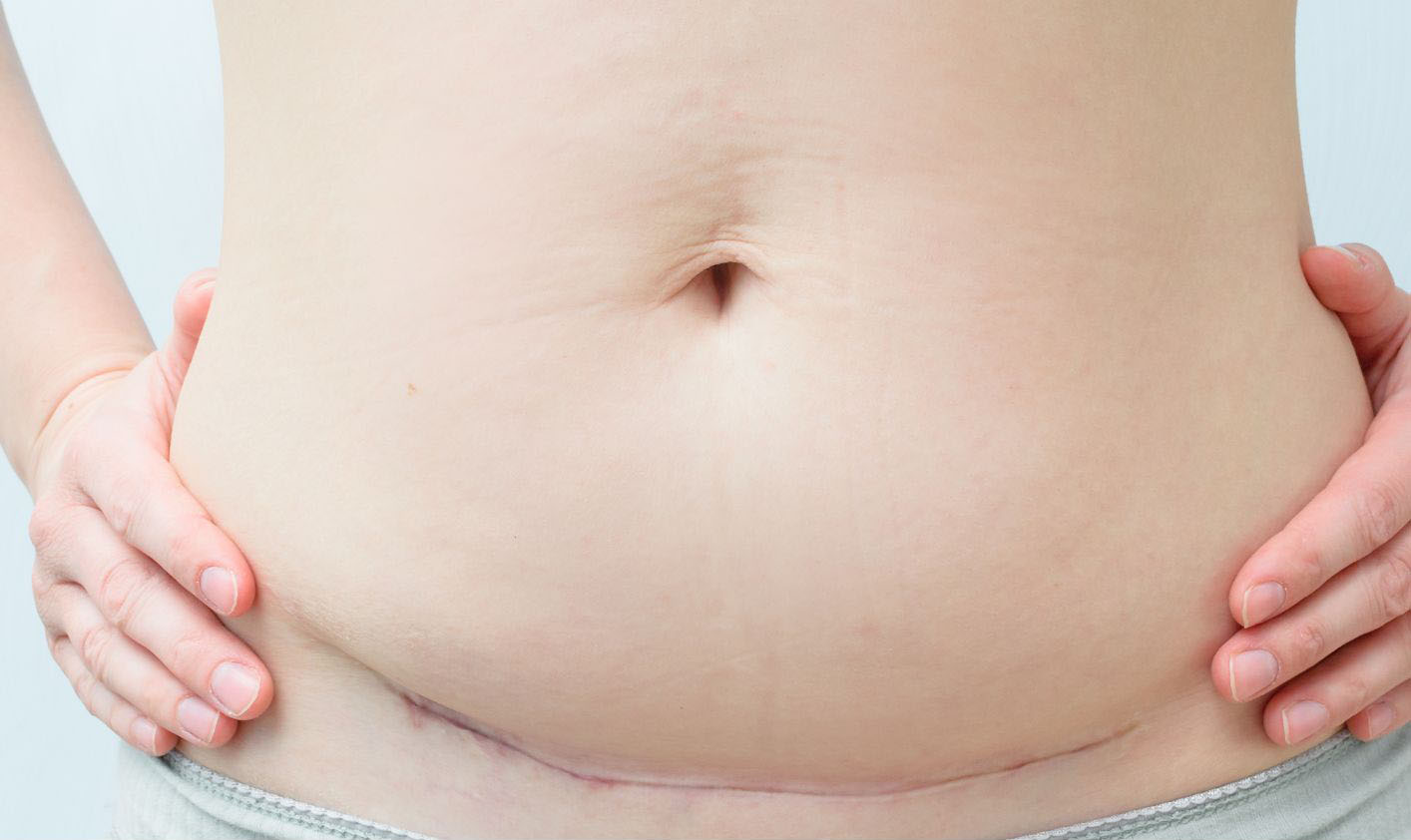 Réflexologie, pieds, soulagement